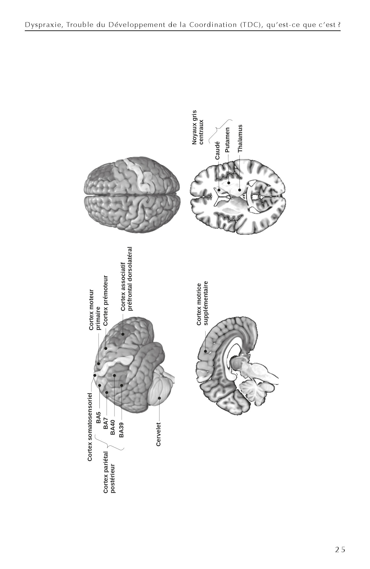 100 IDEES POUR MIEUX COMPRENDRE ET ACCOMPAGNER LES ENFANTS DYSPRAXIQUES 